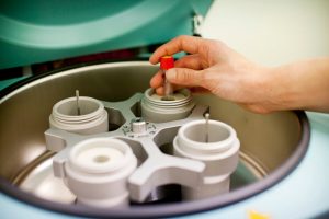 kvinnligt fertilitetstest