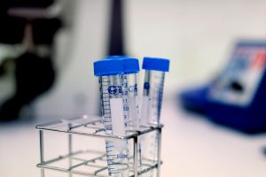 fertilitetsutredning - hur går det till? En del av fertilitetsutredningen innebär att mannen lämnar ett spermaprov.