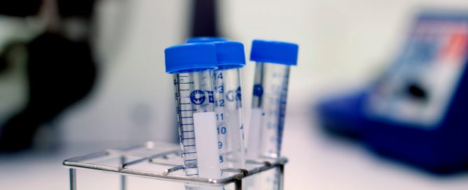 fertilitetsutredning - hur går det till? En del av fertilitetsutredningen innebär att mannen lämnar ett spermaprov.