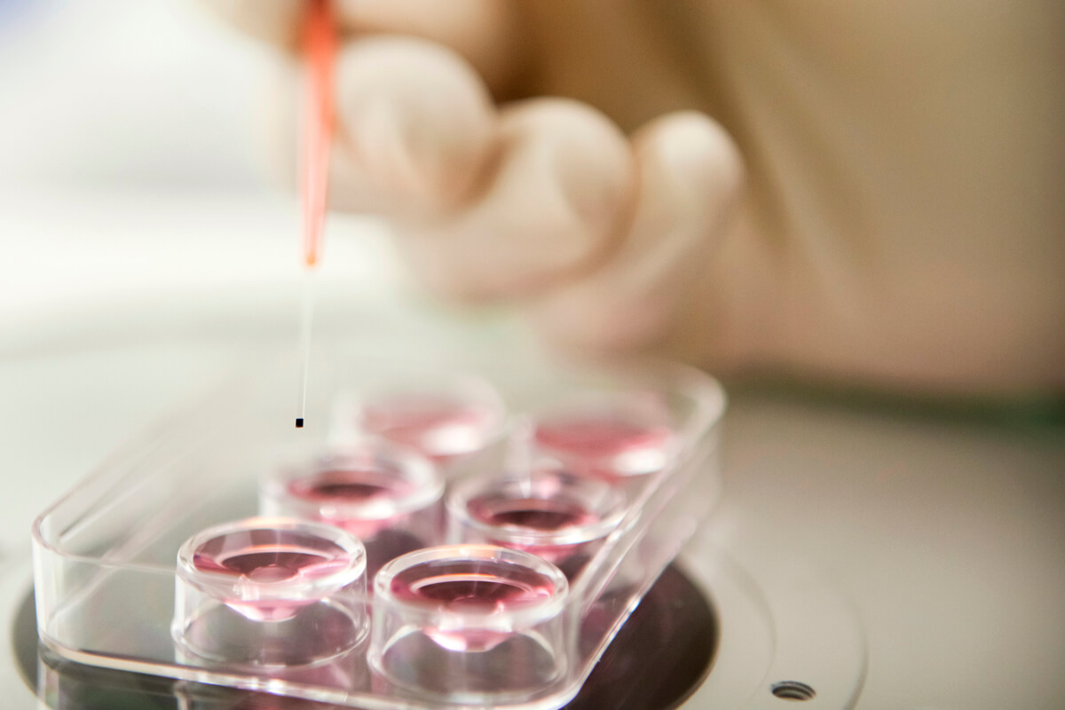 Äggfrysning kostnad