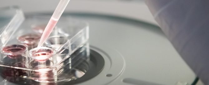 IVF Kostnad stockholm