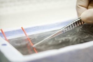 Fertilitetsklinik Göteborg