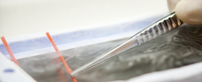 Fertilitetsklinik Göteborg