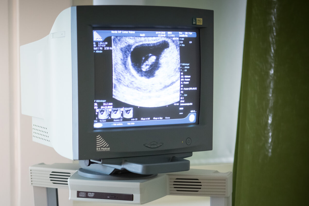 Ägglossning efter missfall