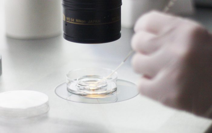 Symptom efter embryoåterföring