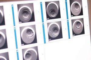 Varför fäster inte ägget i livmodern?